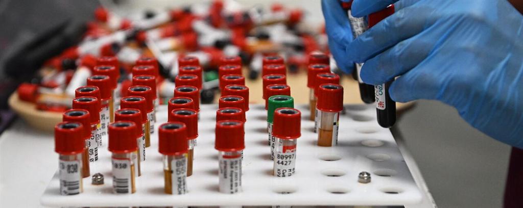 Rusia registra nuevo medicamento para tratar infecciones bacterianas