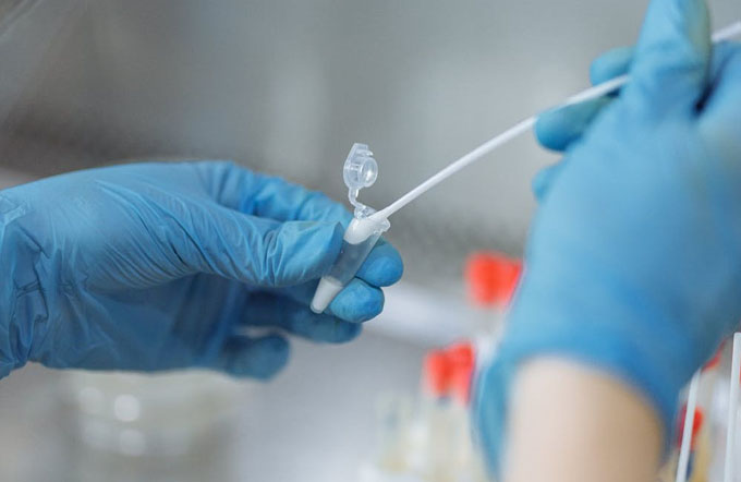 Refuerzan vigilancia epidemiológica ante virus respiratorios